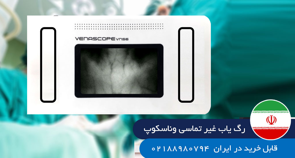 رگ یاب رگیاب